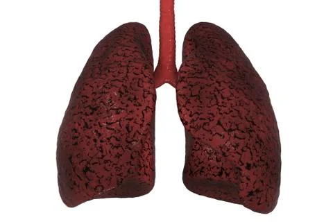Smokers lungs, medical concept Stock Illustration