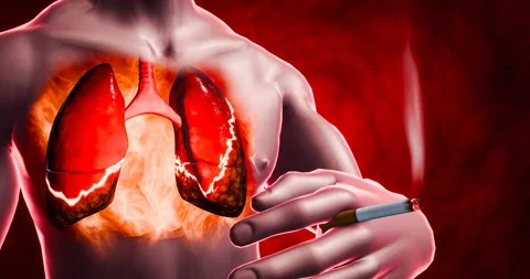 Smoking effects on lungs visualized, showing severe lung disease, tar deposits,  Stock Footage 307882117