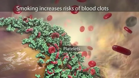 Smoking increases risks of blood clots Stock Illustration
