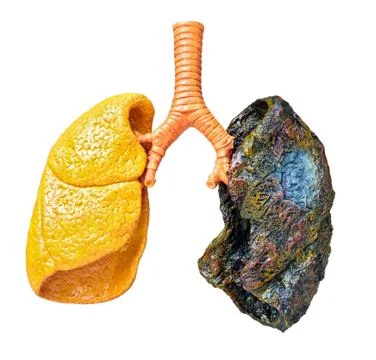 Smoking kills Stock Photos