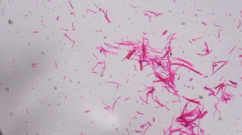 Smooth muscle separate under the microscope  Stock Footage 62444557