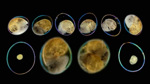 Snail eggs under a microscope Stock Footage 108208879