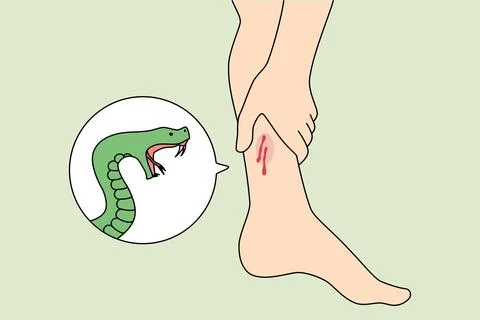 Snake bite person leg Stock Illustration