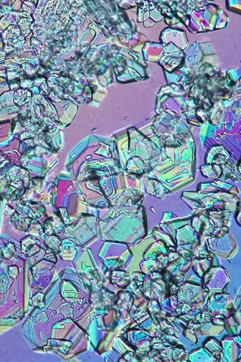 Sodium Hydroxide Crystals at 50x Under Polarized Microscopy Stock Footage 335475138
