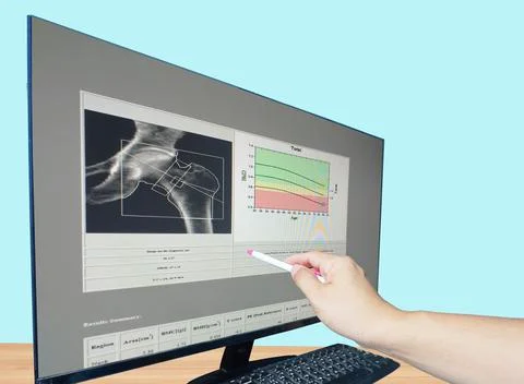 Soft and blurry image Woman's hip bone mass image The graph has a standard po Stock Photos