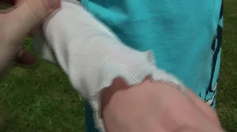 Soft Cast Onto Arm Fitting Stock Footage 12614068