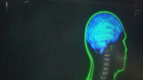 Software showing patient's brain scan results on screen, futuristic diagnostics Stock Footage 71670927