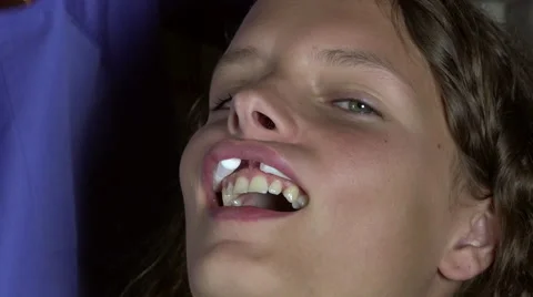 Solidification of a composite operation Stock Footage 53007159