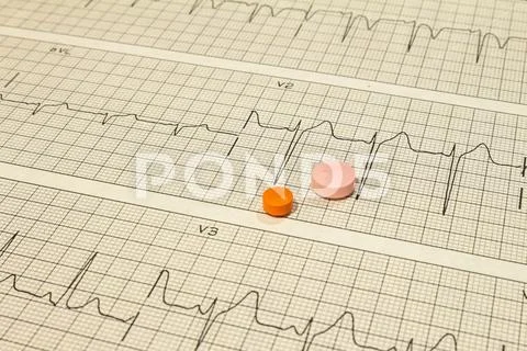 Some pills on electrocardiograms. Records of cardiac activity. Licensed drugs Stock Photos