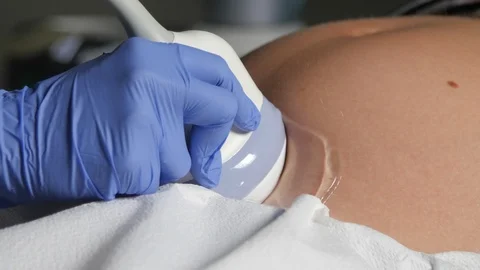 Sonogram close-up 스톡 동영상 118422487