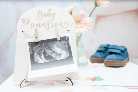 Sonogram displayed with tiny shoes and pastel details. Commercial stock for Stock Photos