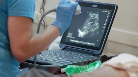 Sonographer makes notes on image Stock Footage 114181403