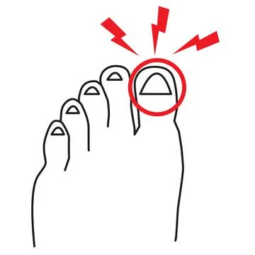 Sore big toe icon pn white background. foot pain sign. leg with a toe injury Stock Illustration