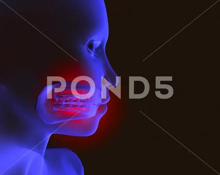 Sore mouth and toothache Stock Illustration