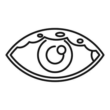 Sore red eye suffering from conjunctivitis illustration Stock Illustration