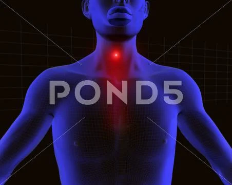 Sore throat Stock Illustration