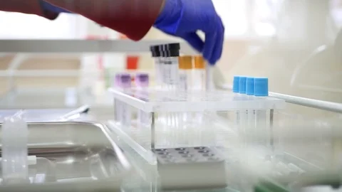 Sorting test tubes with blood samples in racks Stock Footage 102778167