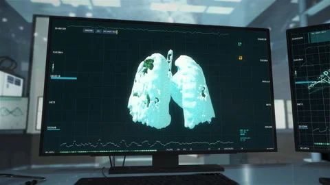 Sorting through Covid-19 CT scans. 3D X-ray data analysis. Medical research. UI Stock Footage 148792391