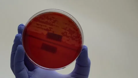 Sowing bacteria on a Petri dish Video stock 147194927