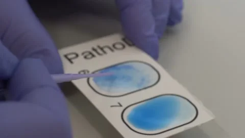 Sowing bacteria on a Petri dish Stock-Footage 147195092