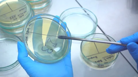 Sowing on a petri dish. Stock Footage 88199796