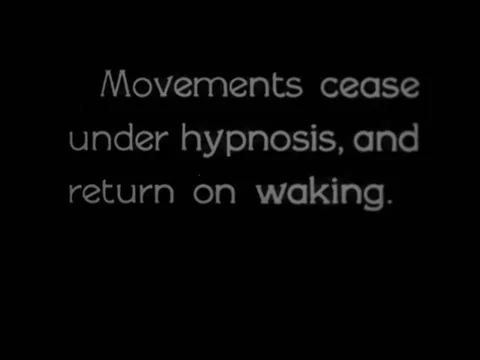 Spasm ceases under hypnosis, but return on waking - 1917 Stock Footage 97229320