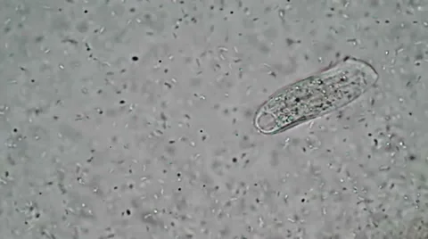 Spathidium Feeding Video stock 38423354