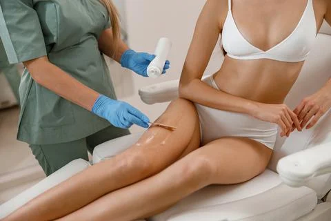 Special ointment applied on client legs before laser epilation procedure in Stock Photos