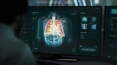 Specialist Analyzing Lungs Condition In Modern Computer Program To Detect Virus Stock Footage 267173239