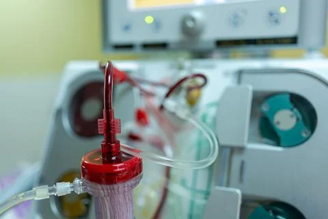 The specialist are checking continuous renal replacement therapy equipment an Stock Photos