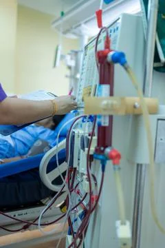 The specialist are checking continuous renal replacement therapy equipment an Stock Photos