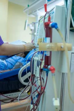 The specialist are checking continuous renal replacement therapy equipment an Stock Photos