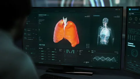 Specialist Is Working In Advanced Medical Program Analyzing Patient's Data Vídeo Stock 152803504