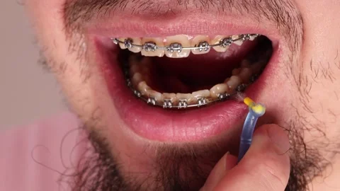 Specialized interdental toothbrush for cleaning between teeth against opened men Stock Footage 263133558