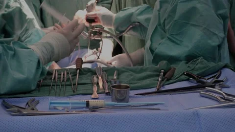 Specialized surgical team performing endoscopic procedure in the operating room Stock Footage 151461442