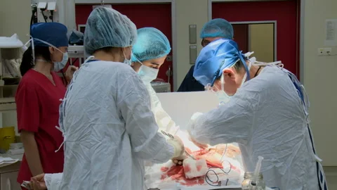 Specialized Team Performing Surgery In Operating Room Stockbeeldmateriaal 86330598