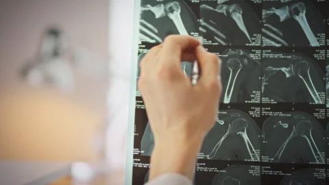 In specialized X-ray room doctors hand points to bone injuries on MRI scans Stock Footage 346393007