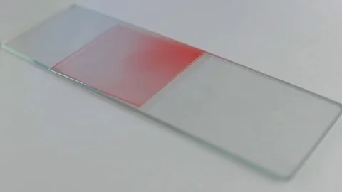 A specimen of blood (red liquid) is placed on the slide of the microscope Stock Footage 82787652