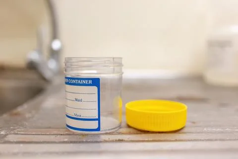 A specimen container for lab test Foto stock