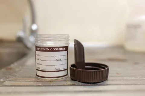 A specimen container for lab test Stock Photos