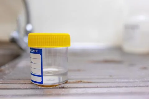 A specimen container for lab test Stock Photos
