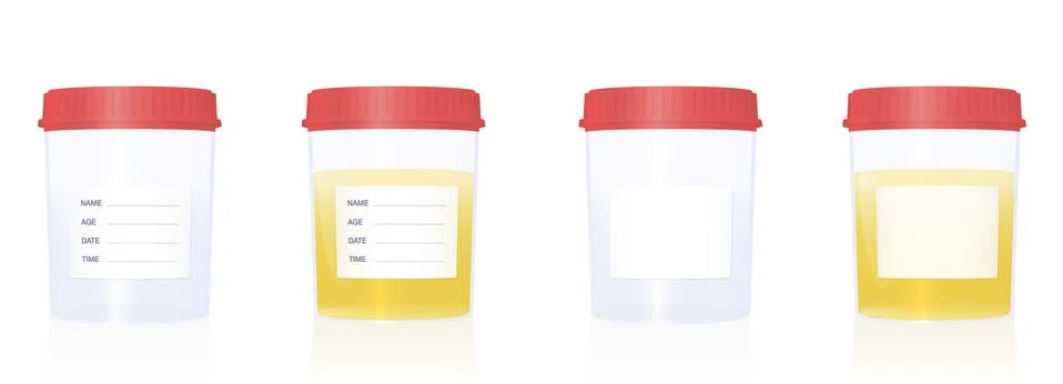 Specimen Cup Empty Urine Sample Blank Label Medical Examination Stock Illustration