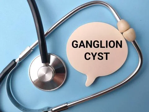 A speech bubble paper cutout labeled GANGLION CYST rests inside the loop of.. Stock-Fotos
