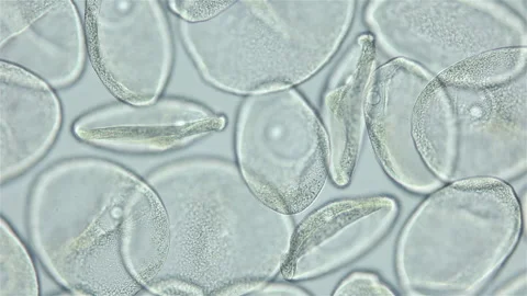 Sperm and ovule of worm Polychaeta Ophelia limacina under microscope, Opheliidae Stock Footage 247434993