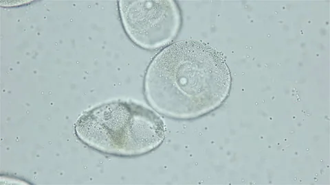 Sperm and ovule of worm Polychaeta Ophelia limacina under microscope, Opheliidae Stock Footage 247435298