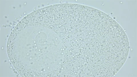 Sperm and ovule of worm Polychaeta Ophelia limacina under microscope, Opheliidae Stock Footage 247462541