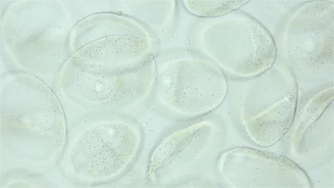 Sperm and ovule of worm Polychaeta Ophelia limacina under microscope, Opheliidae Stock Footage 247505164