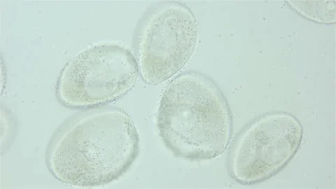 Sperm and ovule of worm Polychaeta Ophelia limacina under microscope, Opheliidae Stock Footage 247631736