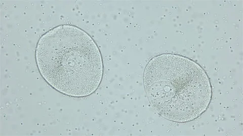 Sperm and ovule of worm Polychaeta Ophelia limacina under microscope, Opheliidae Stock Footage 247632078