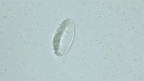 Sperm and ovule of worm Polychaeta Ophelia limacina under microscope, Opheliidae Stock Footage 247684128